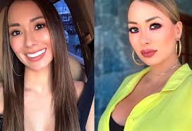 Elena Correa se chinea con arreglitos estéticos