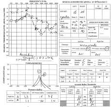 Passer d'Android à iOS : r/HearingAids
