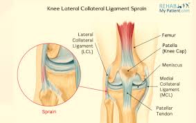 Lcl Lateral Collateral Julie Dass Sports Injury Clinic Facebook