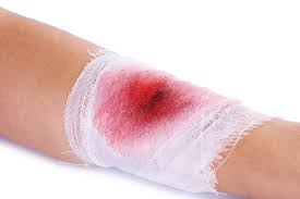 Image result for Wound