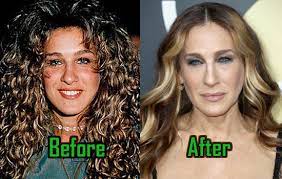 Despite clear unusual face look, parker insists that she has never had aesthetic surgery. Sarah Jessica Parker Plastic Surgery For Boobs And Nose Before After Lights Fashion Beauty