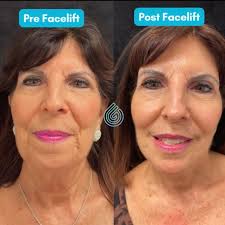 Gold Coast Dermatology