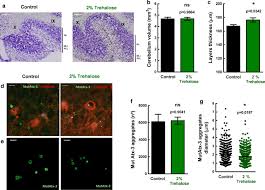Trehalose Alleviates The Phenotype Of Machado Joseph Disease Mouse Models Journal Of Translational Medicine Full Text