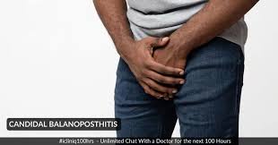 Image result for balanoposthitis