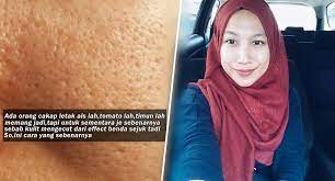 Fungsi pori kat muka adalah untuk mengeluarkan minyak semula jadi dari badan serta nak hilangkan pori memang mustahil lah sis! Stress Liang Pori Macam Kulit Limau Gadis Ini Kongsi Tips Power Kecilkan Pori Pada Wajah Islam Itu Indah