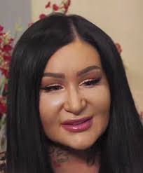 She's the content strategist of. Woman Who Reportedly Spent 1 000 000 On Plastic Surgeries Is So Full Of Filler She Can T Move Her Face Botchedsurgeries