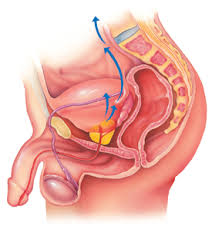 There are a number of different treatments doctors recommend. Prostate Cancer Capital Health Hospitals