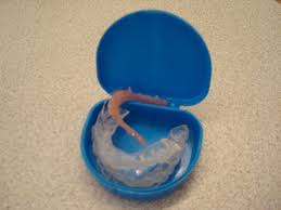 I'm looking for a product that i can use to spray on stubborn dirt/grime on paint to loosen them before rinsing the car and using the 2 bucket method. That S Disgusting Not Washing Your Retainers News Kansan Com