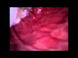 Check spelling or type a new query. Swallowed Camera And Mic Vore By Firebolt2526