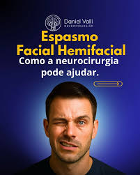 🧠 Espasmo Facial Hemifacial: Quando o Rosto Trepida Sem Aviso Contrações  involuntárias de um lado do rosto que vão ficando cada vez mais frequentes  e difíceis de controlar? Isso pode ser um