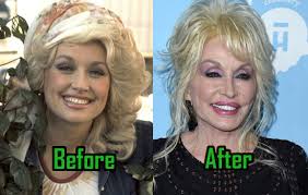 The netflix original series, next up. Dolly Parton Can T Live Without Plastic Surgery Celebritysurgeryicon