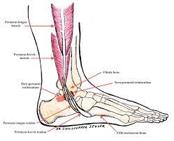A small incision about 1 cm long was made in the previous incision. Peroneal Tendon Subluxation Doc