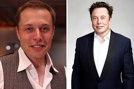 Elon musk was the second entrepreneur in the silicon valley (the first one was james h. Elon Musk Haartransplantation Welche Methode Hat Er Genutzt