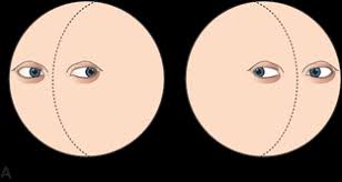 Image result for Oculovestibular Testing