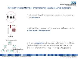 Down Syndrome This Powerpoint File Contains A Number Of