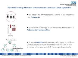 down syndrome this powerpoint file contains a number of