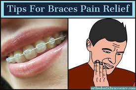 So how can you relieve braces pain? 25 Tips For Braces Pain Relief Orthodontic Braces Care