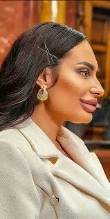 Srpska napredna stranka