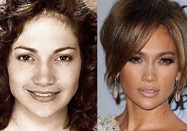 Дженнифер лопес начинала свою творческую карьеру, примеряя роль танцовщицы в фильме. Plastika Dzhennifer Lopes Byla Ili Net 300 Ekspertov Ru