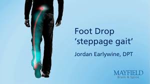 Image result for Foot Drop