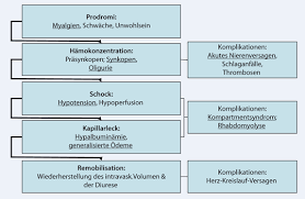 Da ytemiche kapillare leckyndrom it eine eltene erkrankung, die durch wiederholte maive aulaufen von plama au den blutgefäßen in benachbarte körperhöhlen und. Schock Hamokonzentration Und Generalisierte Odeme Bei 47 Jahrigem Patienten Springerlink