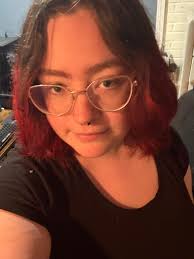 How bad did your floating naval hurt? Once I get down to my goal weight, I  plan