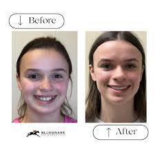 Bluegrass Orthodontics