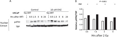 Here are 10 more facts about prostate cancer. Plos One Radiosensitization By Enzalutamide For Human Prostate Cancer Is Mediated Through The Dna Damage Repair Pathway