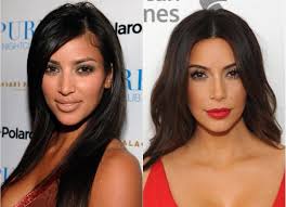 Celebrity Plastic Surgery 30 Before And After Pics Kardashian Plastic Surgery Celebrity Plastic Surgery Kim Kardashian Surgery