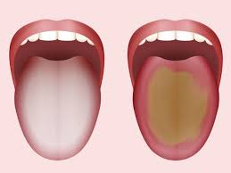 Click on a country or territory to see cases, deaths, and recoveries. Auf Welche Krankheiten Ein Zungenbelag Hindeuten Kann Azertag Aserbaidschanische Staatliche Nachrichtenagentur