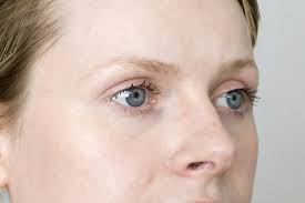 Thinning Eyebrow Hair Is Often One Of The Many Side Effects Of Hypothyroidism A Hormonal Disease Effecting The Thyroid Thin Eyebrows Eyebrows Thyroid Problems