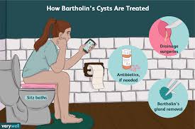 Image result for Bartholin's gland abscess