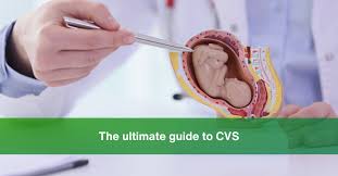 Image result for Chorionic Villus Sampling
