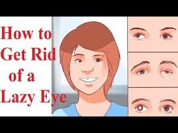 How To Get Rid Of A Lazy Eye Youtube Eyes Problems How To Get Rid Eyes