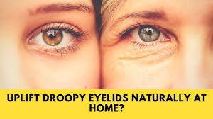 Check spelling or type a new query. How To Lift Droopy Eyelids Naturally At Home