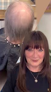 Contact us about our Manchester hair loss studio