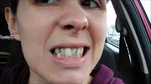 We did not find results for: Denture Before And After Youtube