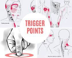 Pe el se insera muschii: Terapia Trigger Points Cursuri Physio Sport Therapy Academy