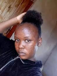 Some people complexion online dey like milk but when u meet them, dier face  get 3500 big pimples like David Stone 🪨 for Bible🙄