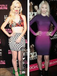 Pin On Celebrity Plastische Chirurgie