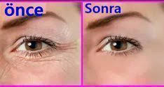 Merhaba Simdiye Kadar Cok Yazip Cizdik Cilt Bakimi Siyah Nokta Akne Derken Bugun Sizlere Daha Zorlu Bir Bolge Face Mapping Acne Wrinkle Remover Face Wrinkles