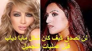 مما لاشك فيه ان عملية ازالة الشعر الغير مرغوب فيه عمليه تتم الحاجه اليها باستمرار وفي جوانب منها هي شي من سنن الفطره وعلى مدى الازمان هي طريقة سهلة ورخيصة وتعتبر من اكثر الطرق استخداما لدى النساء وهي أكثر الطرق استعمالا في صالونات التجميل والعناية. ÙŠØ§Ø³Ù…ÙŠÙ† Ø§Ù„Ø®Ø·ÙŠØ¨ Ù‚Ø¨Ù„ Ø¹Ù…Ù„ÙŠØ§Øª Ø§Ù„ØªØ¬Ù…ÙŠÙ„ ÙˆØ¨Ø¹Ø¯Ù‡Ø§ Ø£ØºØ§Ù†ÙŠ Mp3 Ù…Ø¬Ø§Ù†Ø§