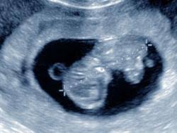 Schwangerschaftswoche (ssw) beginnen sie stetig an gewicht zuzunehmen und die organe ihres kindes sind nun fertig entwickelt. Entwicklung Zwillinge Im 3 Monat Ssw 9 Seite 2 Babywelten Ch