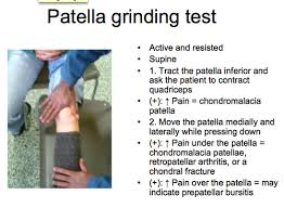 Image result for Patella Grind Test
