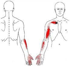 Pin On Joint Pain Relief