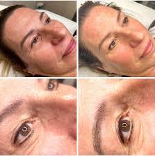 This is emma tattersall as anybody else lost there fb and instagram that  they use for freebies and testing products mine just gone this morning i  appealled and lost im gutted lost