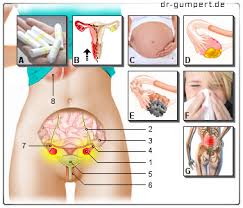 Kann das schon die dehnung der mutterbänder sein oder ist das zu früh? Schmerzen Des Linken Eierstocks Ist Das Gefahrlich