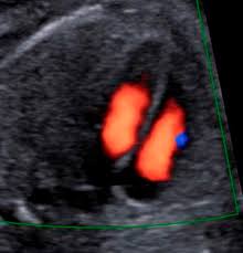 Dass diese untersuchung auch feinultraschall genannt. 3d 4d Ultraschall Und Organscreening Bei Frauenheilkunde Herten