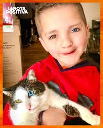 💙🐱 Niño que sufría acoso por ser diferente adopta a un gato igual a él y  su historia conmueve al mundo Madden Humphreys, un niño de 7 años de  Oklahoma, nació con