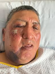 Habla Esteban, el anciano al que tres jóvenes reventaron la mandíbula a  patadas en Parla: "Me tiraron al suelo porque no les daba mi cartera...  Pero no les entendía porque hablaban árabe" |